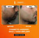 Slider image (7) Orange Tree Aesthetic And Hair Restoration Centre